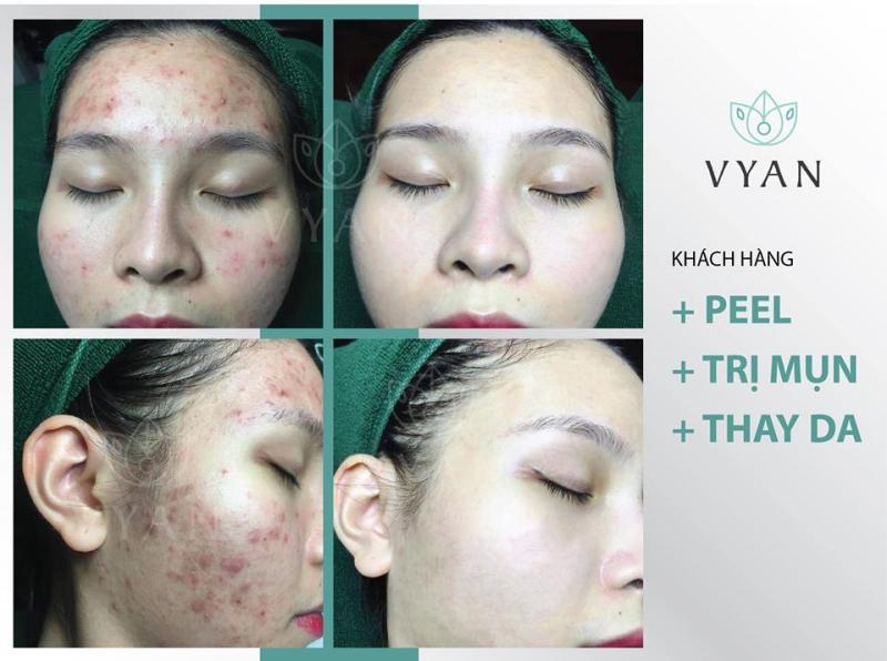 Vy An Spa