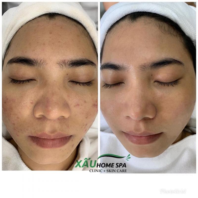Xấu Home Spa