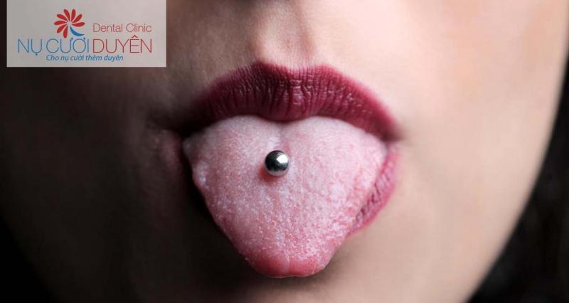 Xâu khuyên không làm bạn đẹp hơn mà khiến răng bạn dễ bị tổn thương.