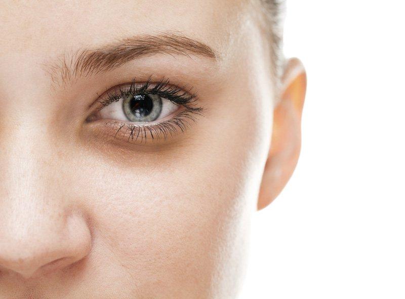 Xuất hiện quầng thâm ở vùng mắt