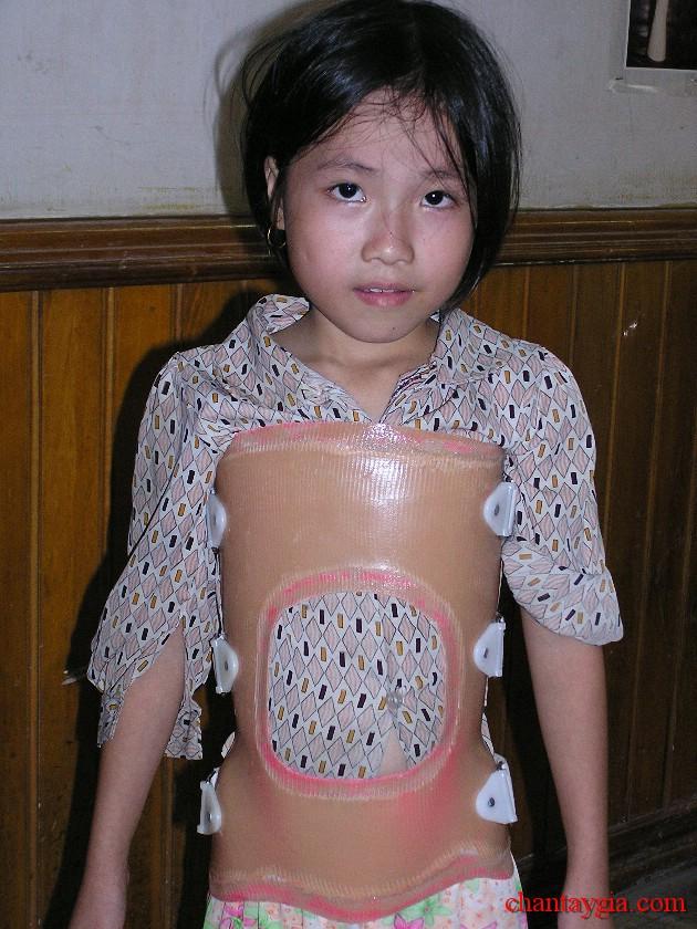 Xưởng chỉnh hình Thảo Nguyên