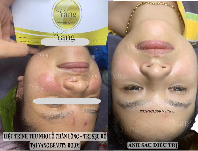Yang Beauty Room